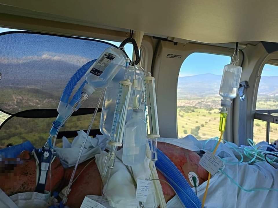 Trasladan vía aérea a lesionado por quemaduras de pólvora en Sanctórum